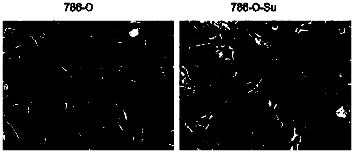 Sunitinib drug tolerance cell line for renal carcinoma, construction method and application of sunitinib drug tolerance cell line