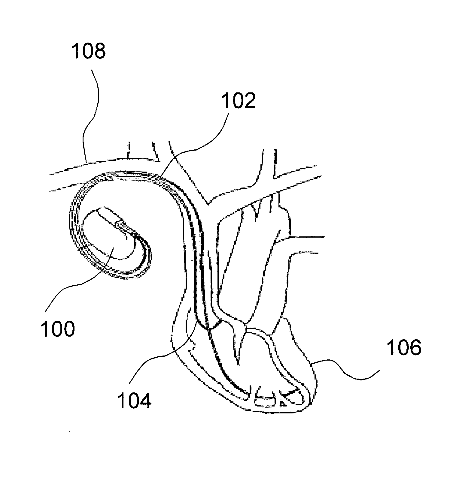 Method and device for collecting rem sleep data