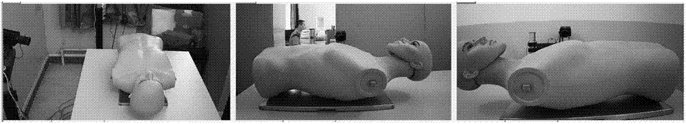 Real-time verification device and method for patient placement in radiation therapy