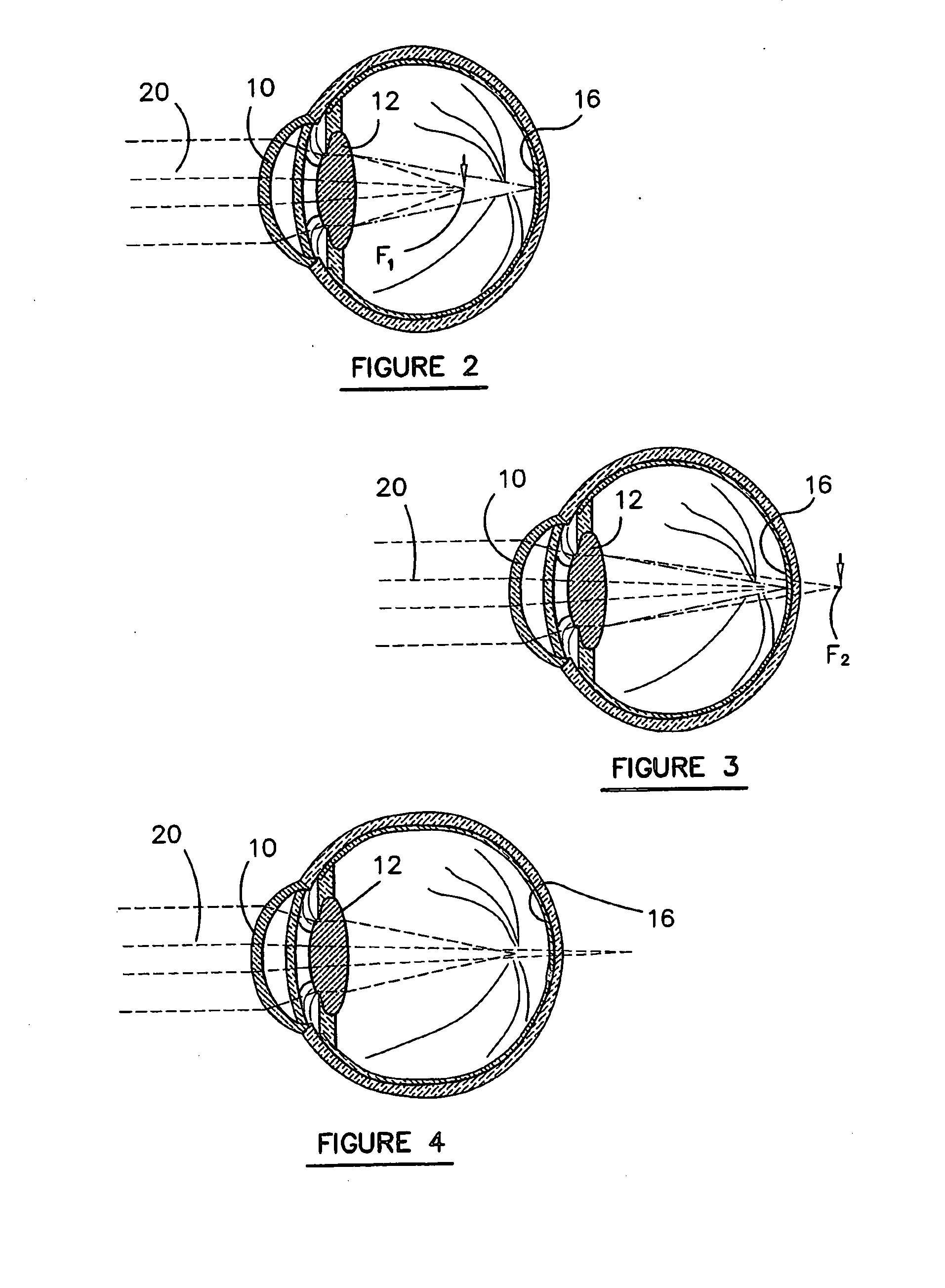 Apparatus and Method for Correcting for Aberrations in a Lens System