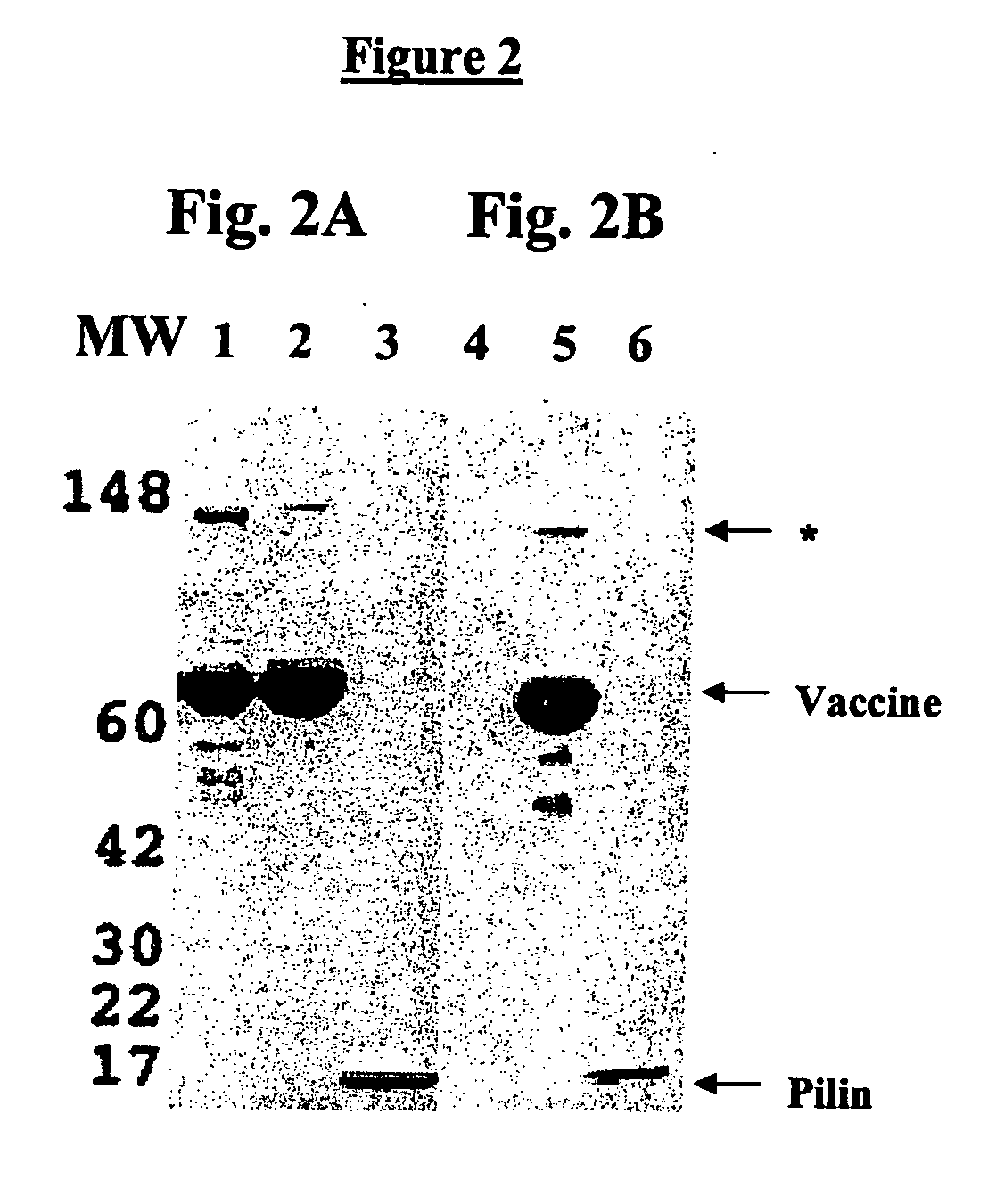 Methods and compositions for immunizing against Pseudomonas infection