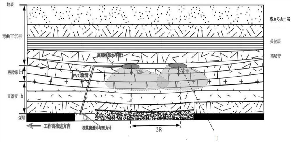A joint method of reducing subsidence by grouting in the inner capsule bag and sealing water-conducting fissures