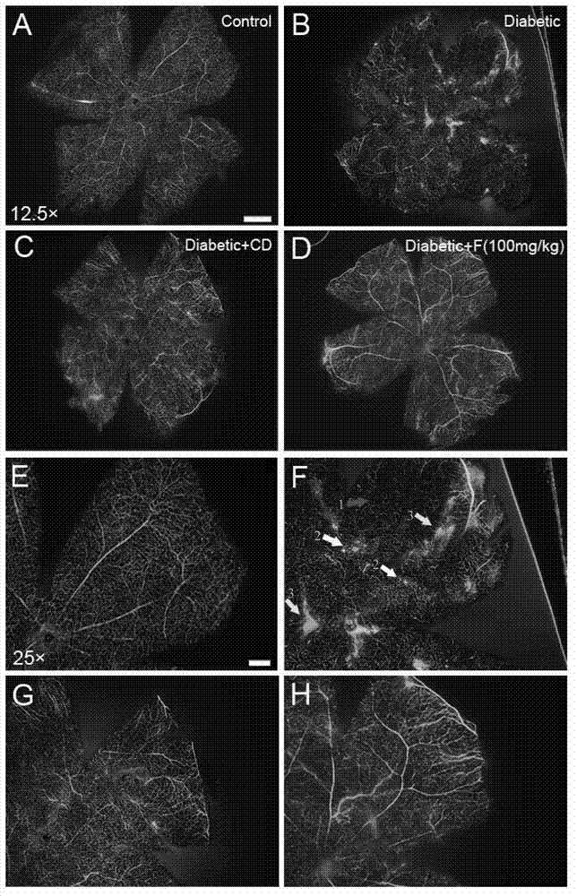 Novel medicinal application of fucoidan polysaccharide sulfate