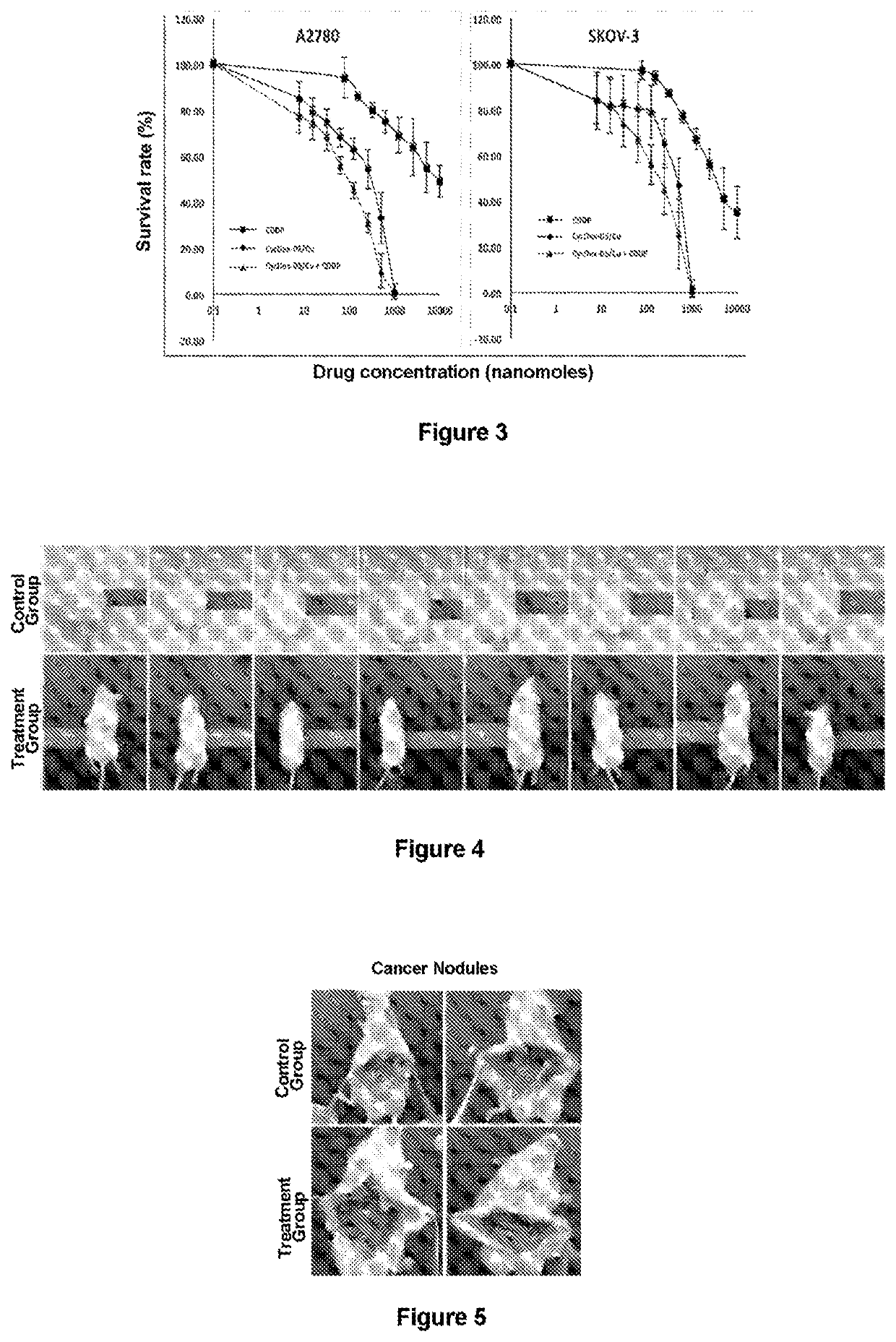 Method for treating pleuroperitoneal membrane cancers by locally injecting disulfiram preparation