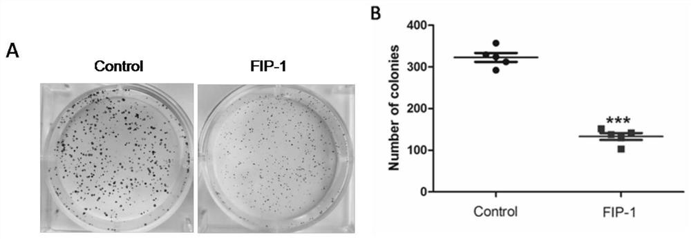 FOXM1 antagonistic polypeptide as well as derivative and application thereof