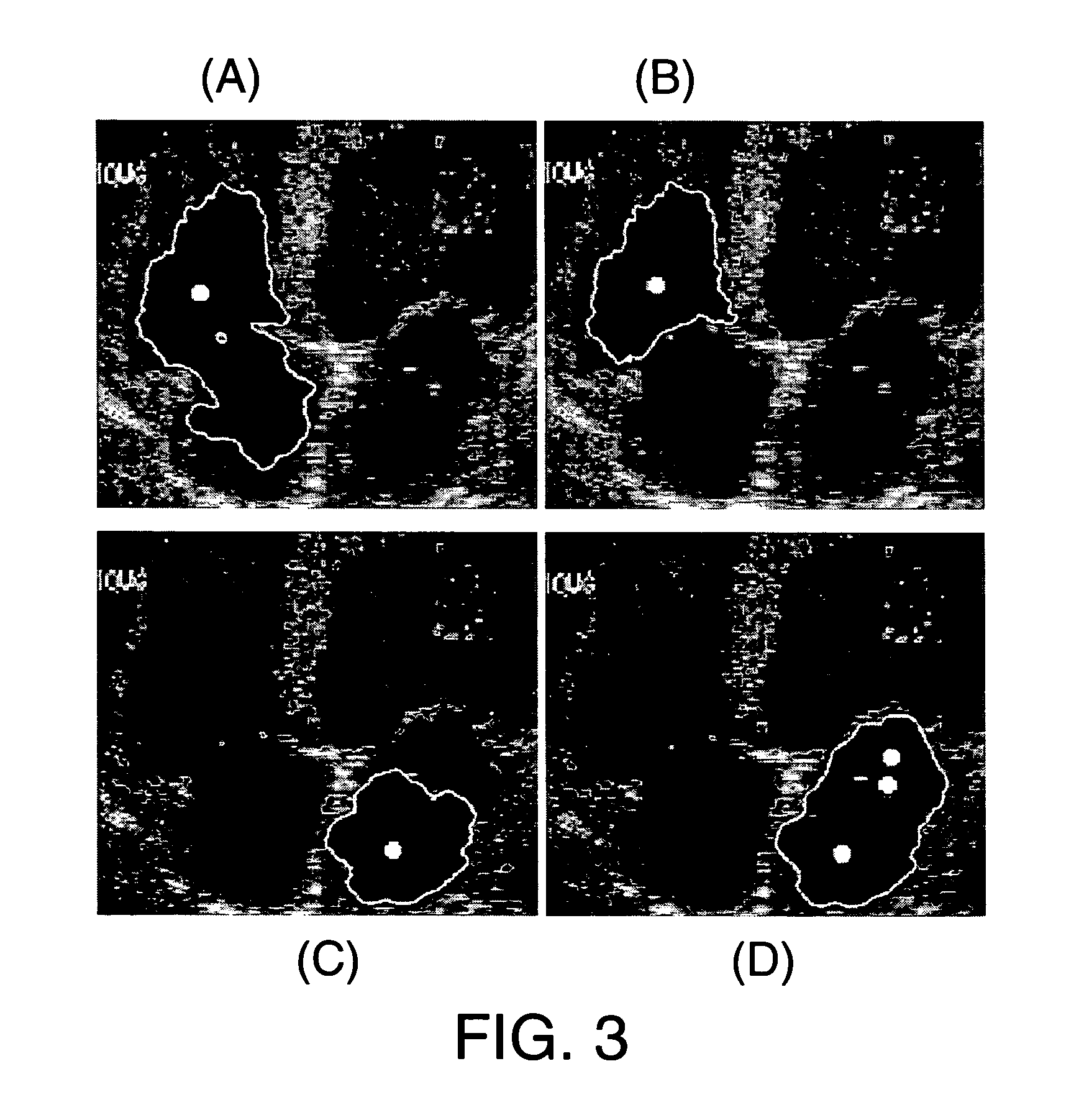 Method and system for interactive image segmentation