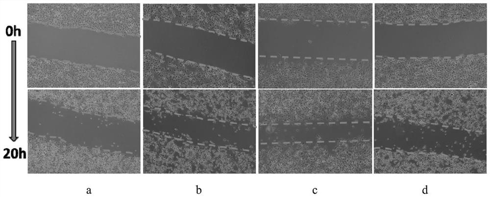 Tissue engineering scaffold of composite exosome nidogen-1 and its preparation method