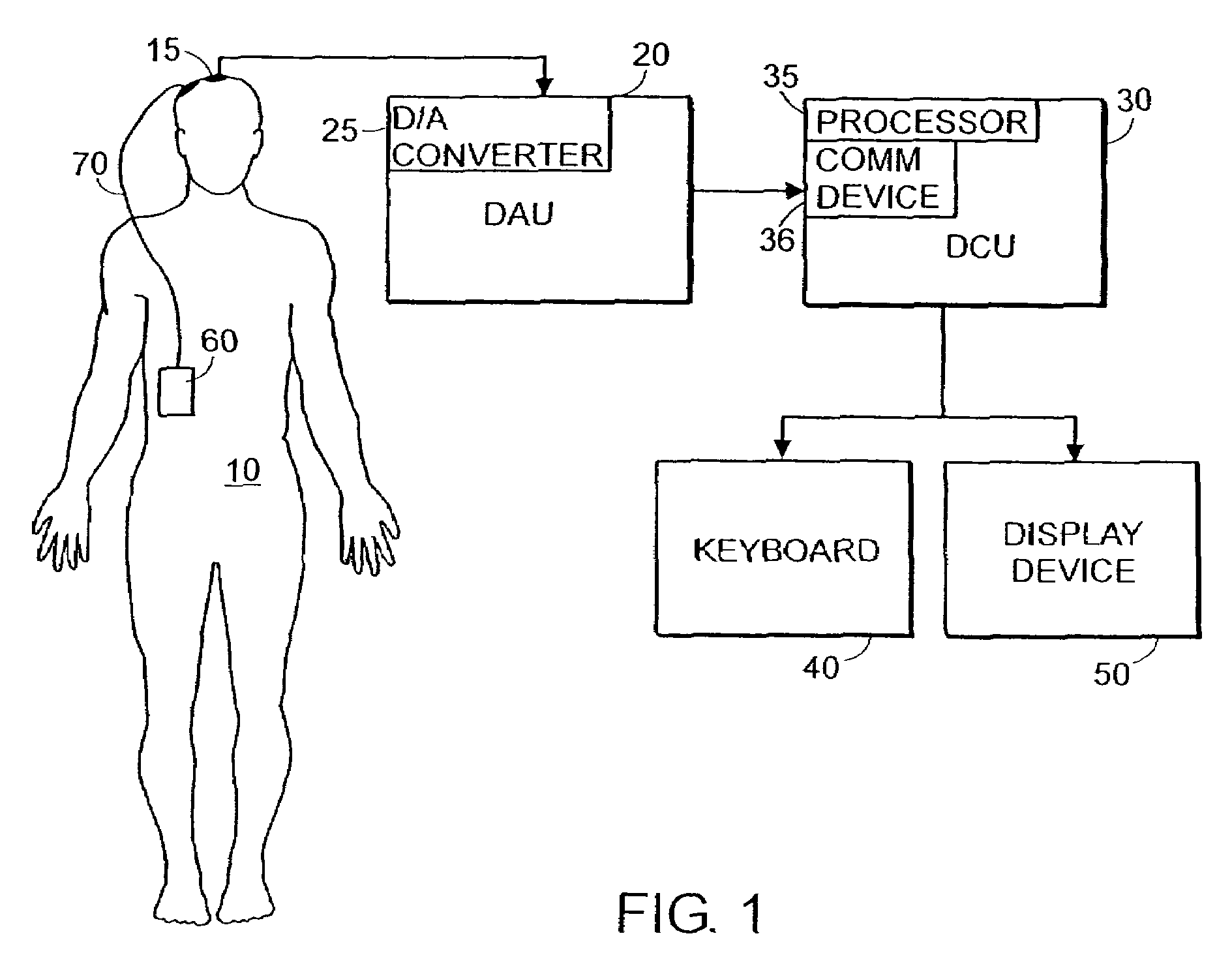 System and method of prediction of response to neurological treatment using the electroencephalogram