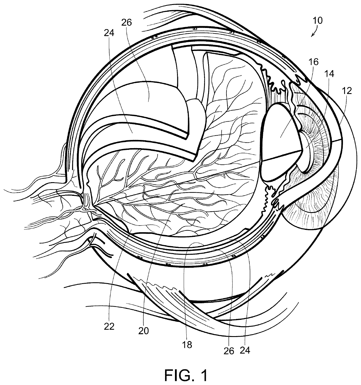 Process for adjusting treatment parameters for retina phototherapy based on RPE melanin levels