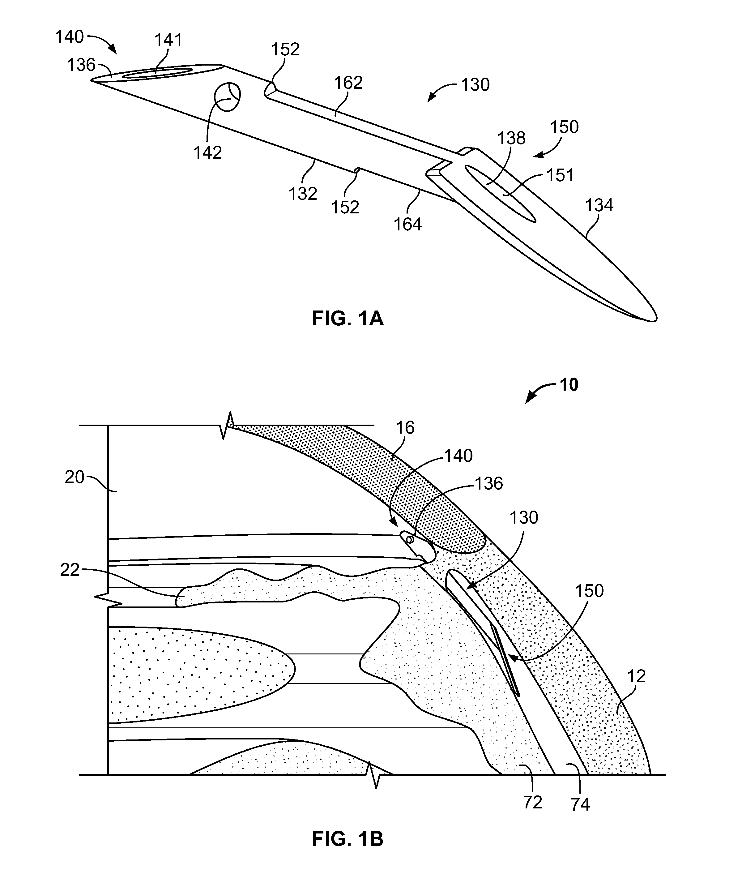 Fluid drainage device, delivery device, and associated methods of use and manufacture