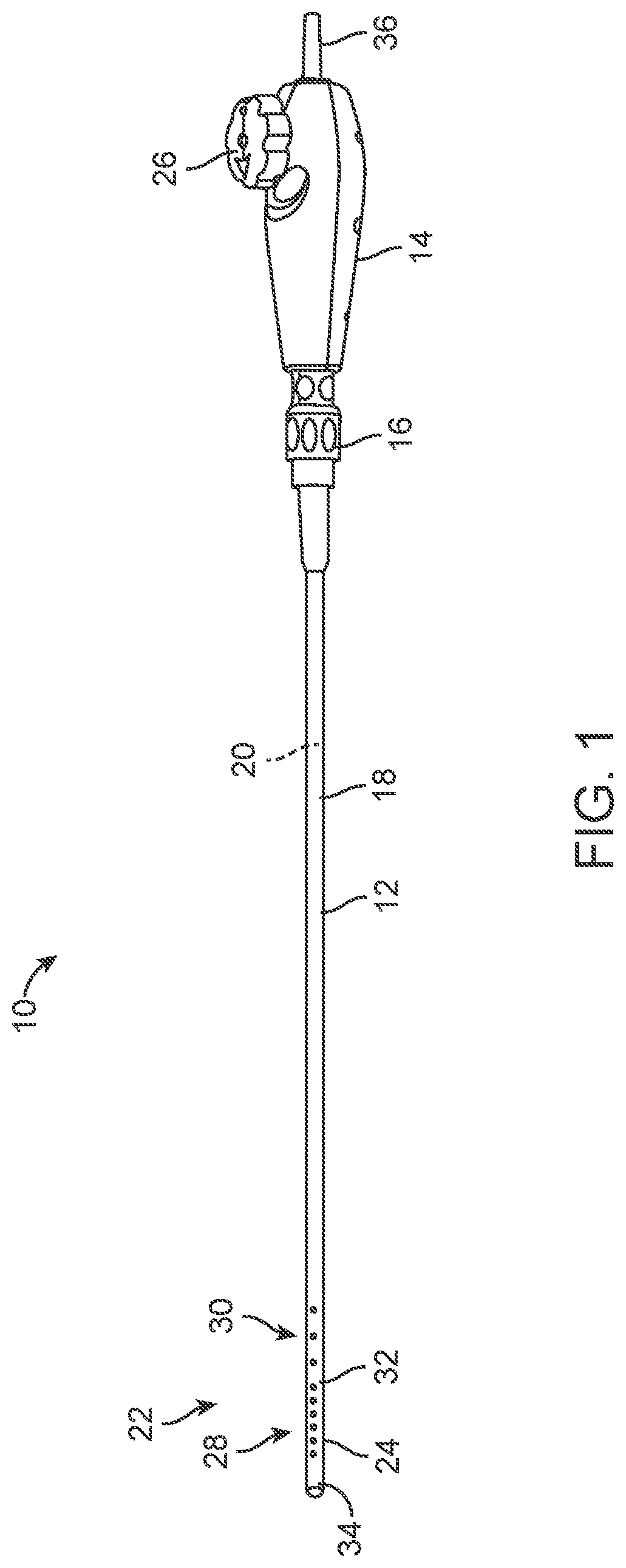 Electromagnetic sensing for use with ablation treatment