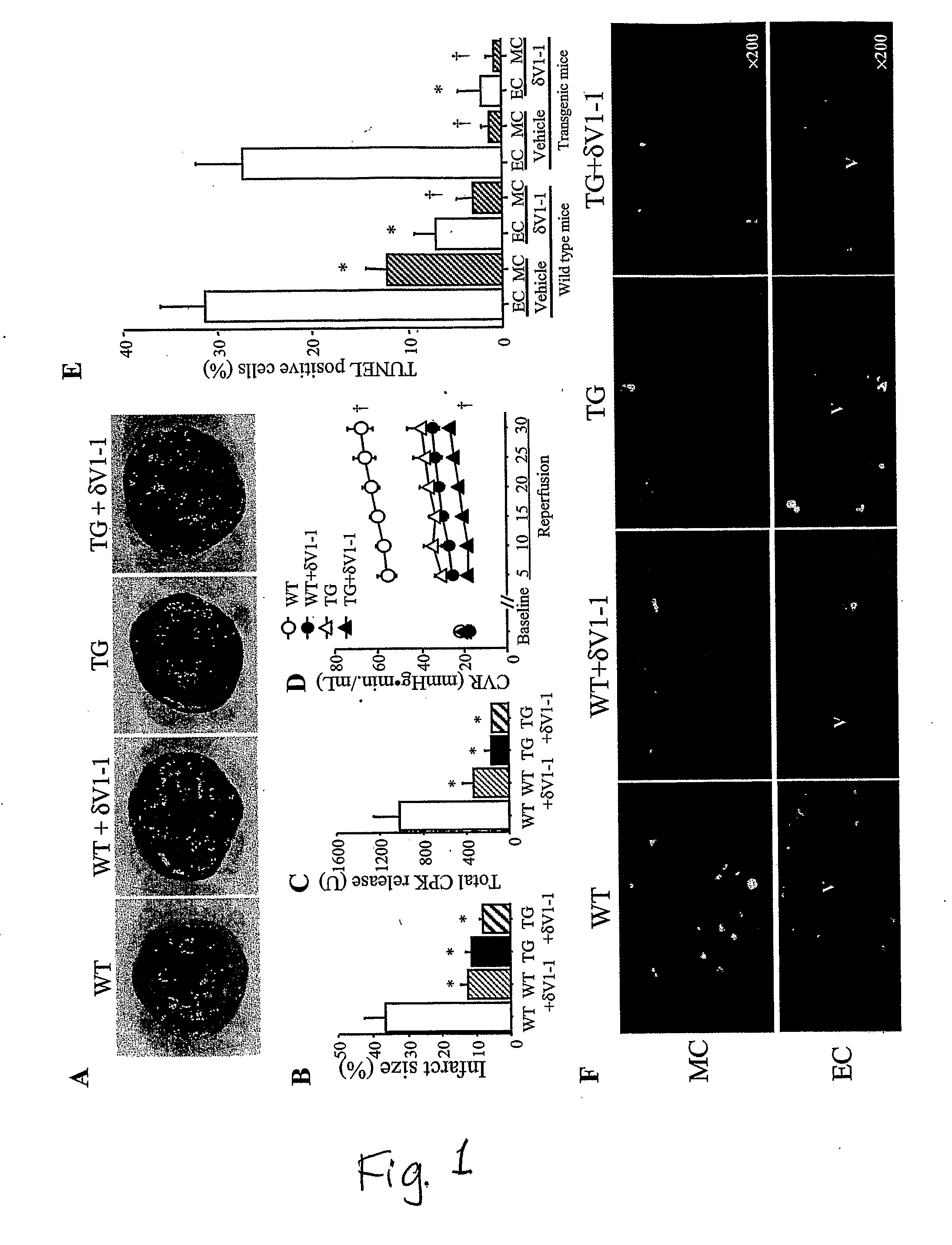 Methods and Compositions for Reducing Ischemia-Derived Microvascular Damage