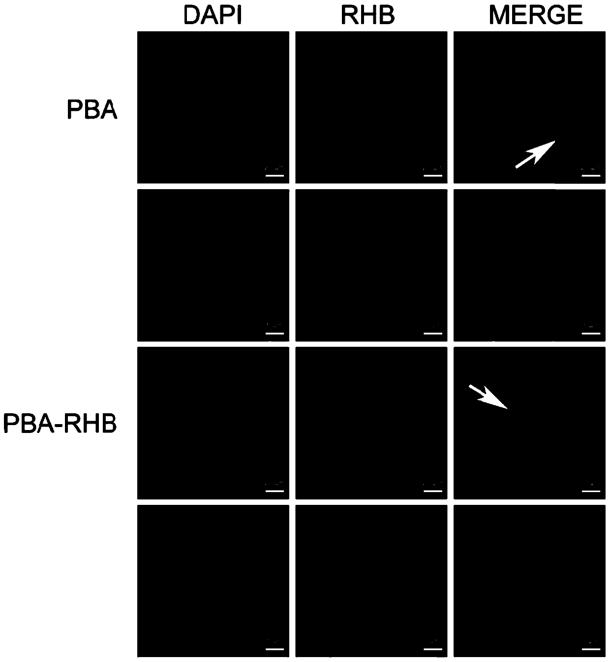 Application of phenylboronic acid in preparing nuclear-targeted boron capture agent