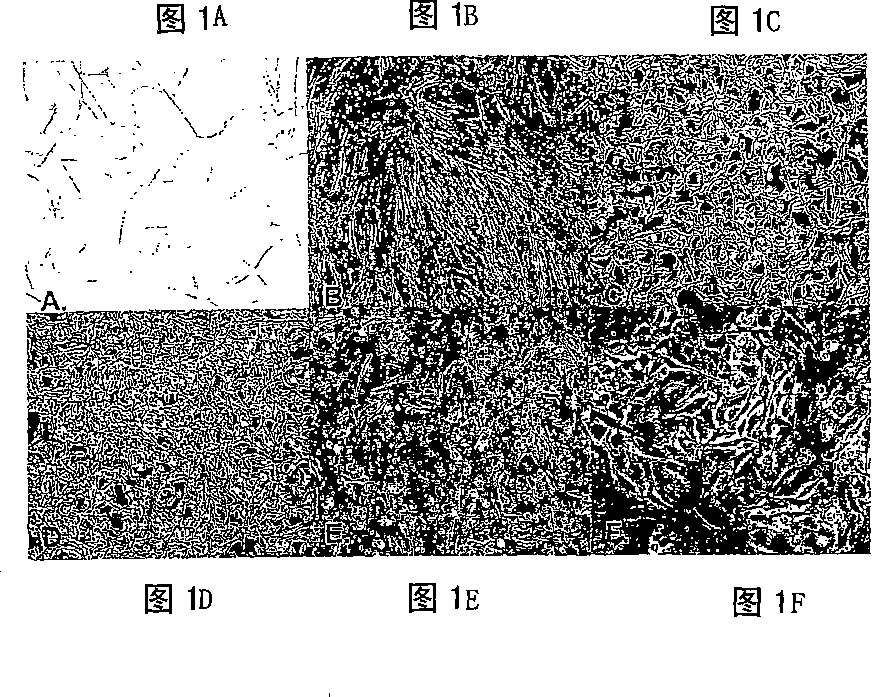 Adipose derived adult stromal cells exhibiting characteristics of endothelial cells