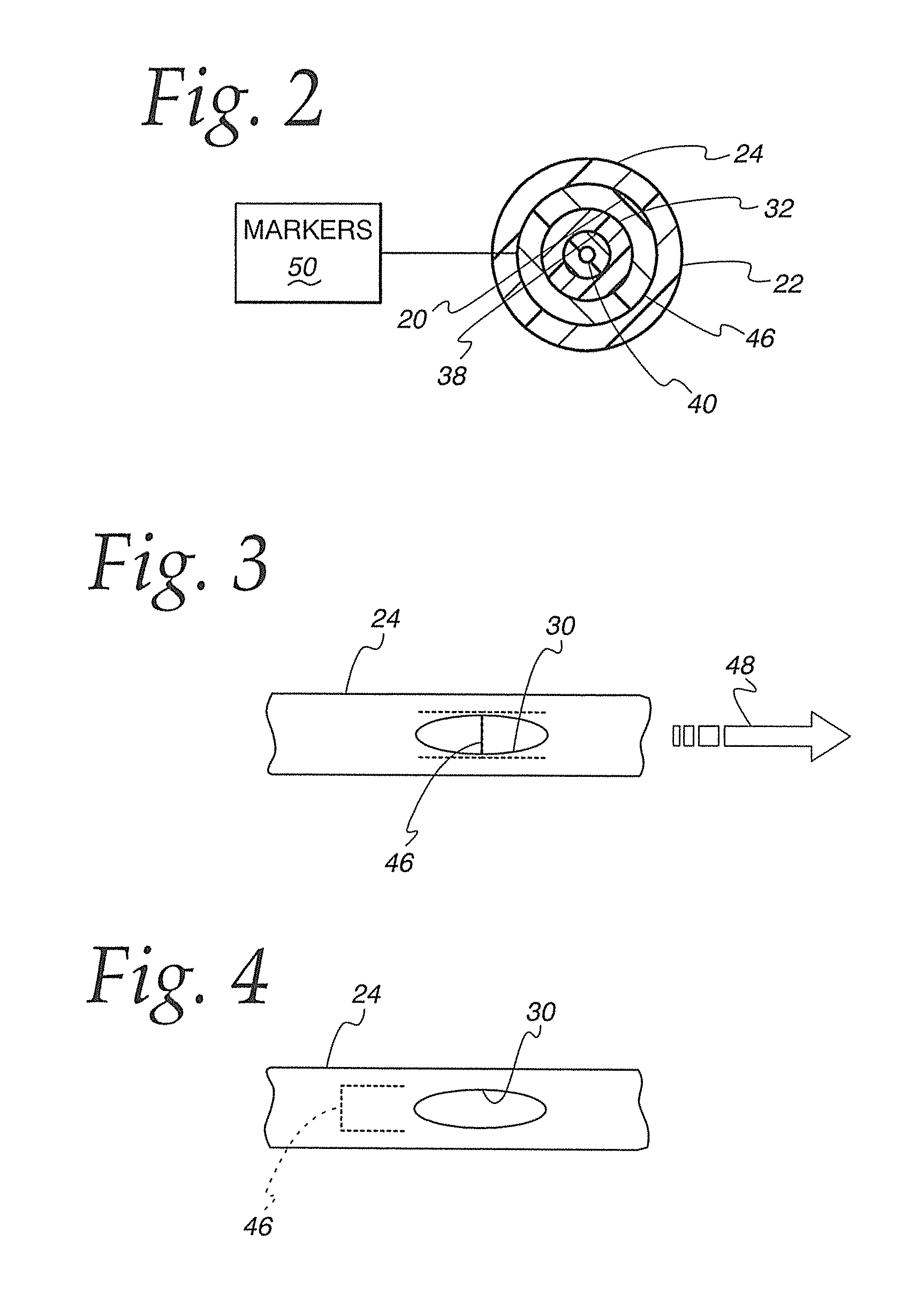 Method of controllably directing a device into a human vessel