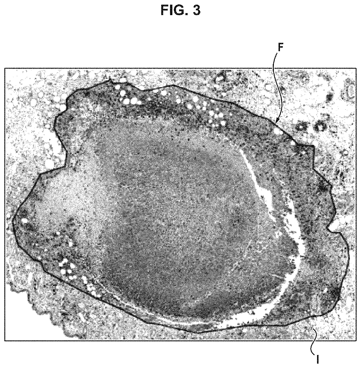 Process for determining the infiltration of biological cells in a biological object of interest