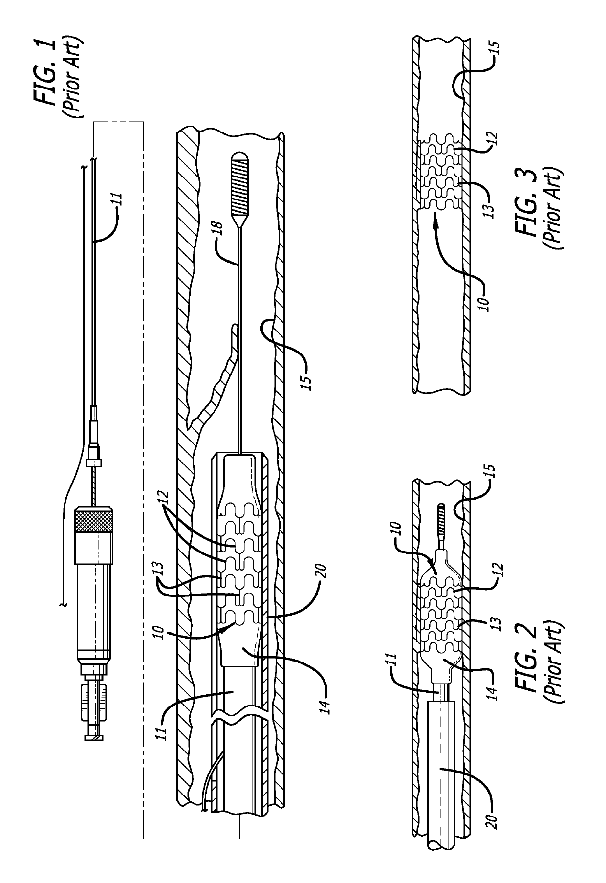 Intravascular stent having high fatigue performance