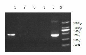 Extraction method of goose parvovirus DNA (deoxyribonucleic acid)
