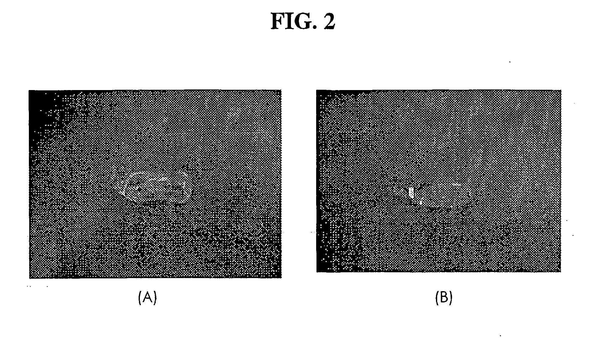 Microemulsion preconcentrate