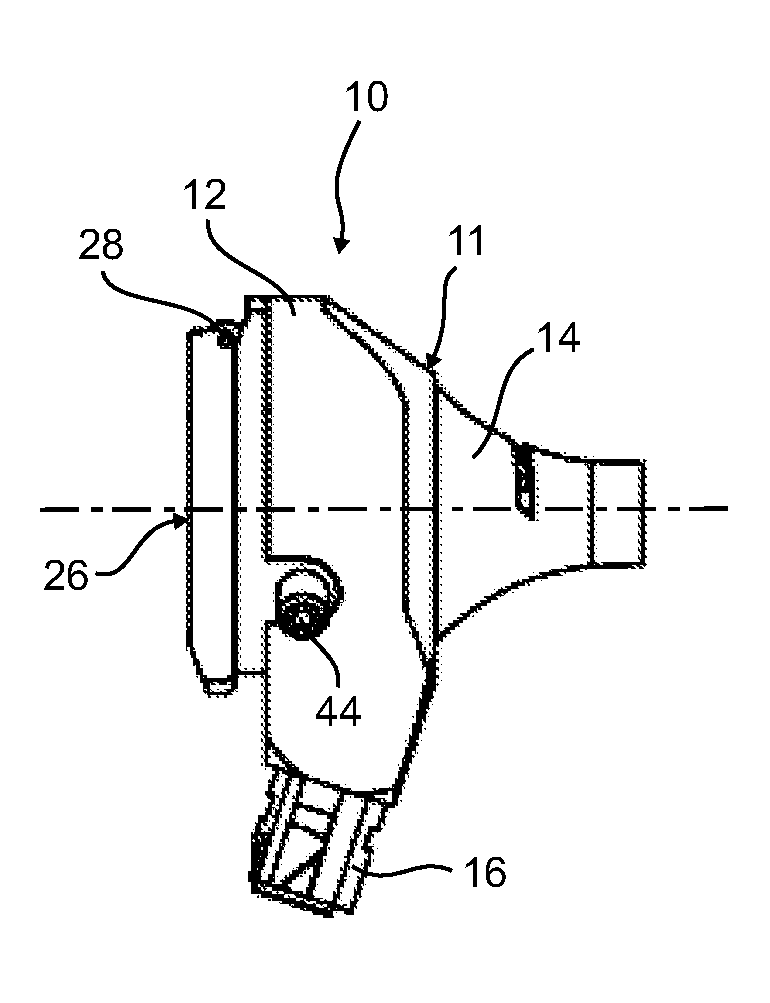 Otoscope