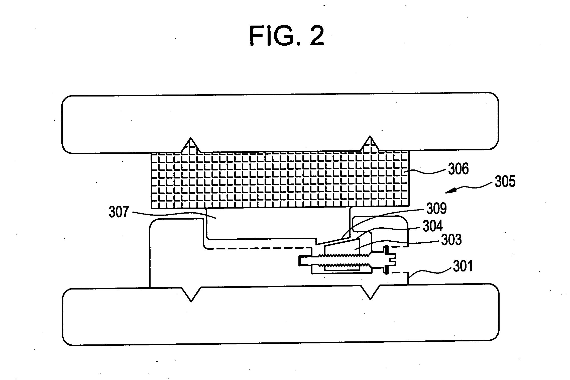 Height-and angle-adjustable motion disc implant