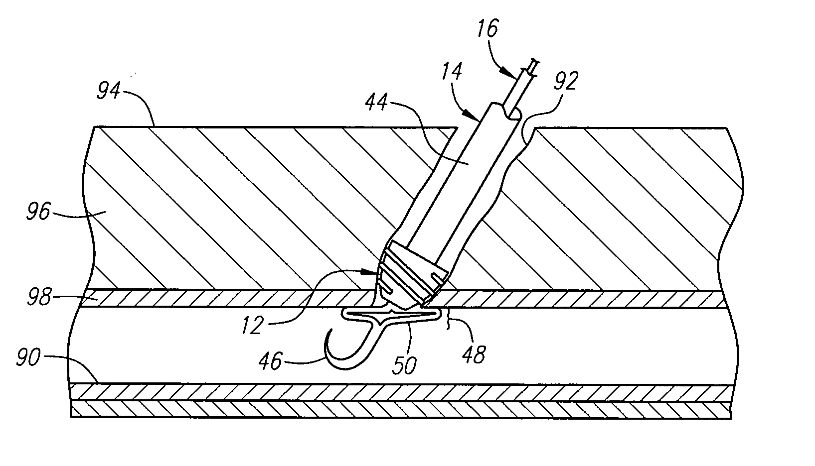Guide wire element for positioning vascular closure devices and methods for use