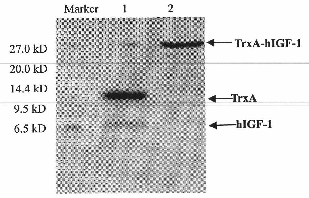Method for producing human insulin growth factor-1 in recombinant Escherichia coli