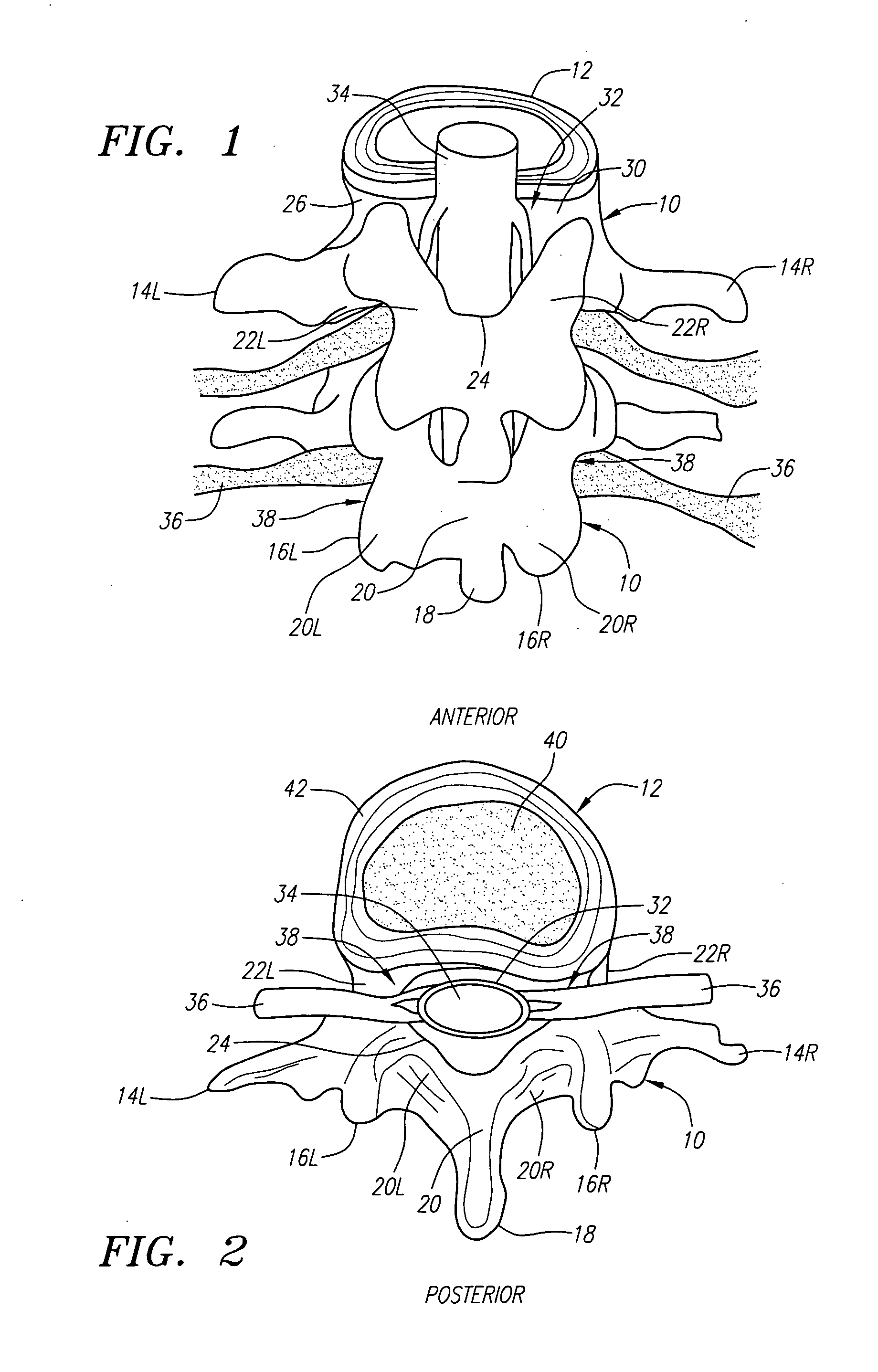 Apparatus and methods for removing vertebral bone and disc tissue