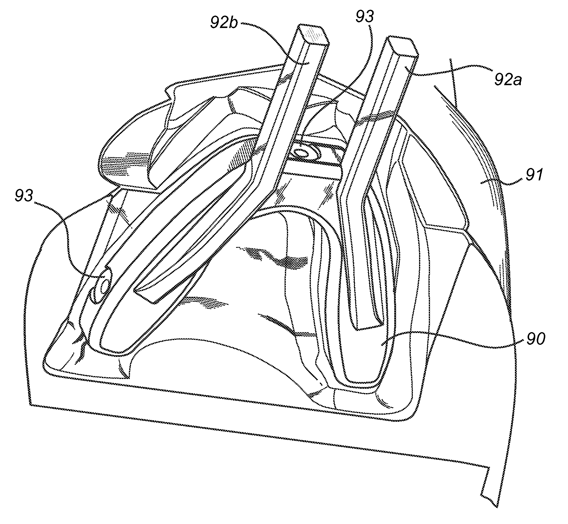 Fixation device