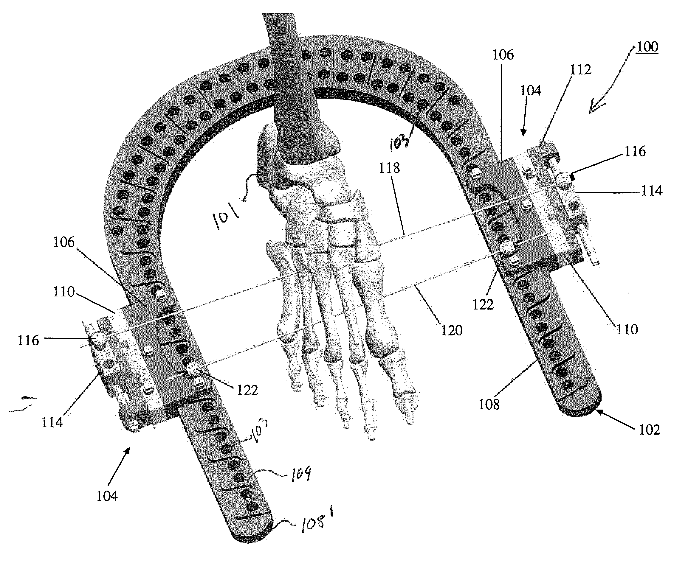 Dynamic External Fixator And Methods For Use