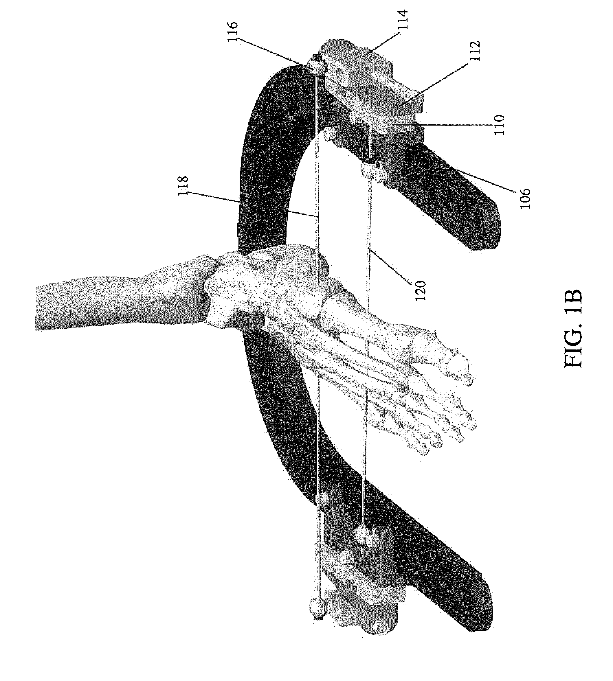 Dynamic External Fixator And Methods For Use