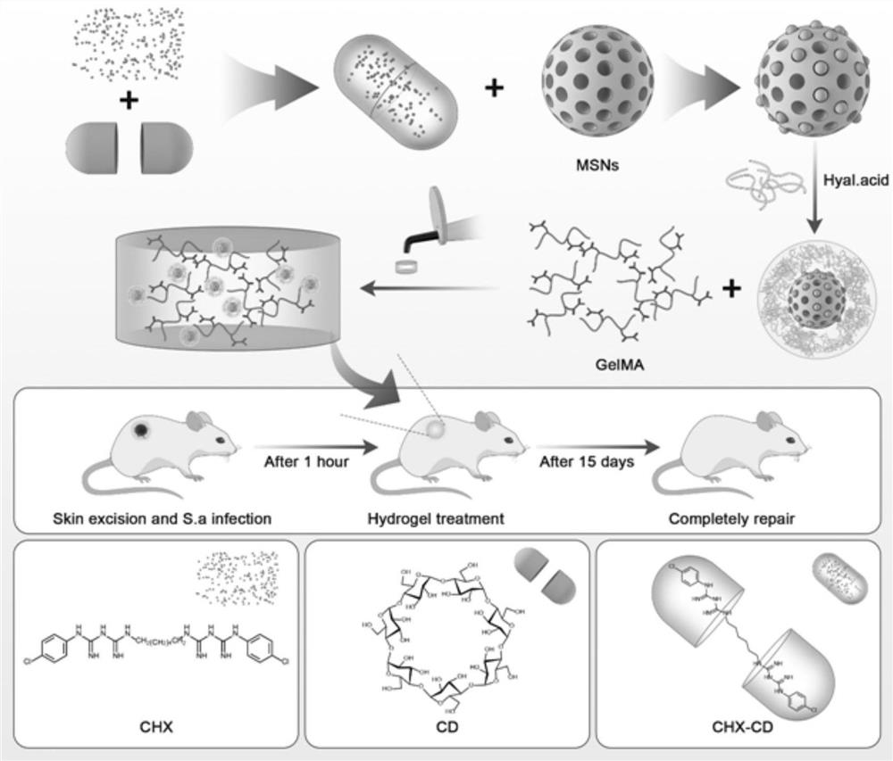 Ultra-long-acting controllable slow-release mesoporous-hyaluronic acid hybrid targeted antibacterial nano-material as well as preparation method and application thereof