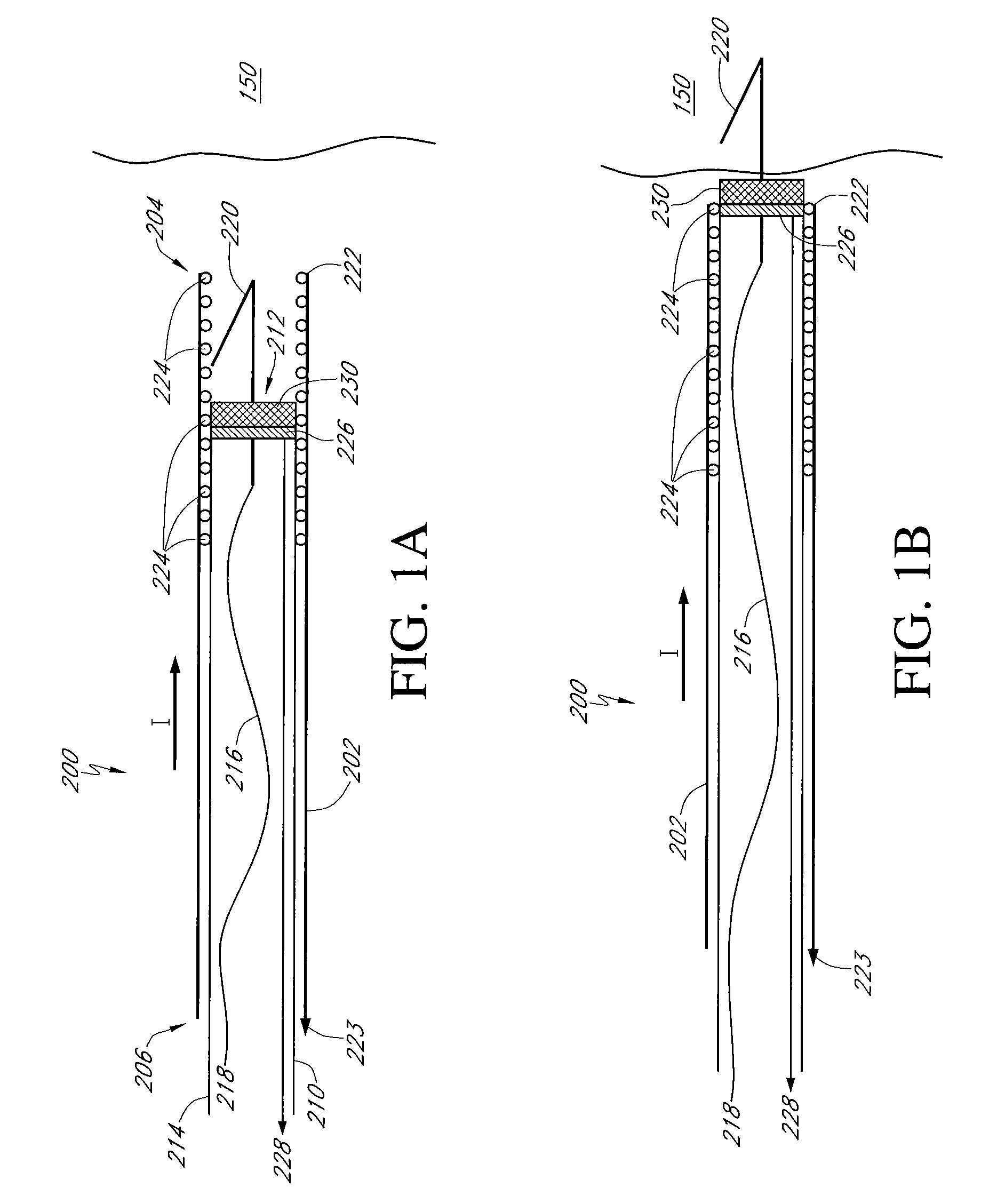 Implantable lead/electrode delivery measurement and feedback system