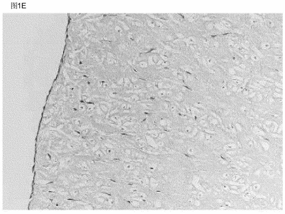 Elastin reduction allowing recellularization of cartilage implants