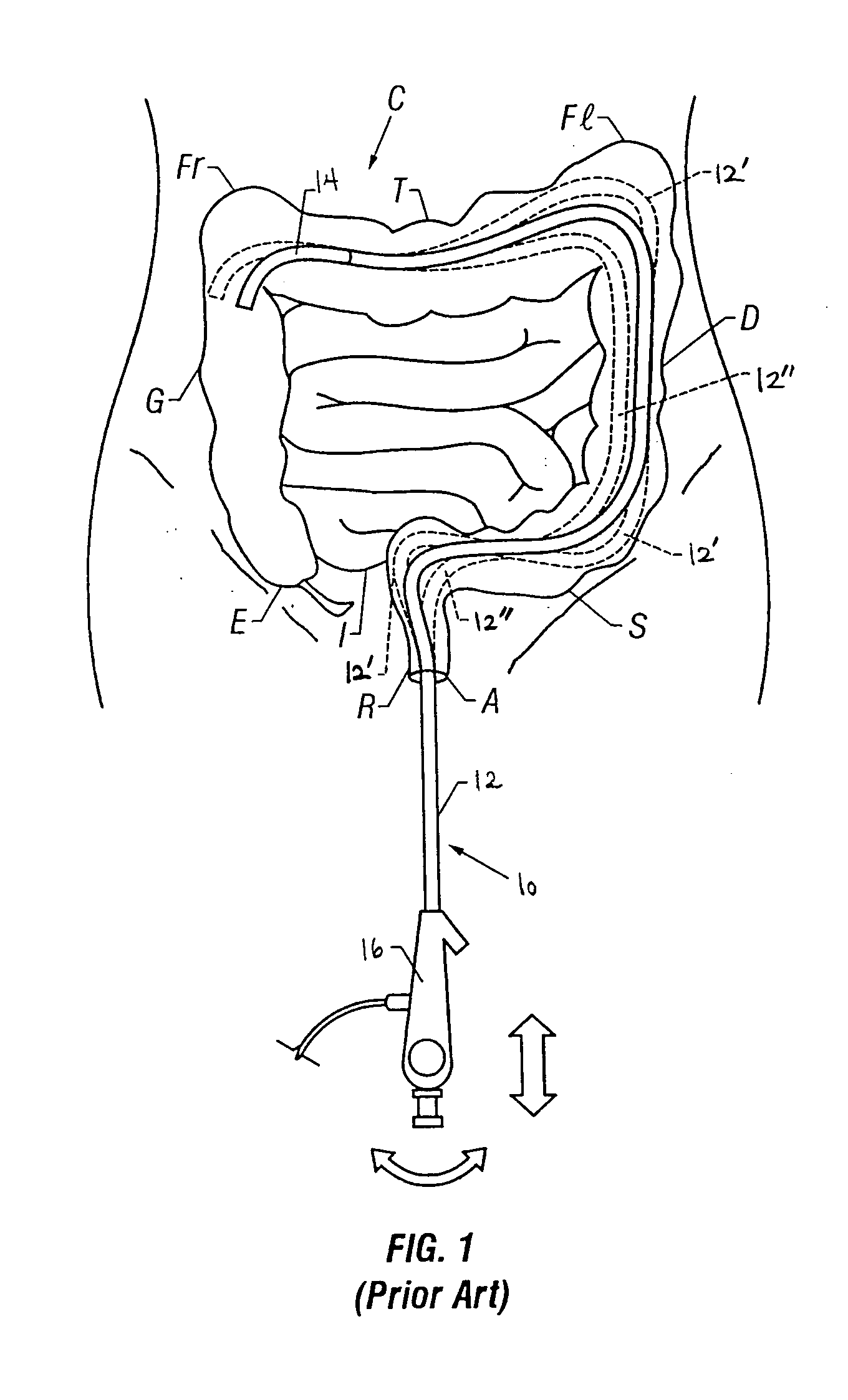 Method and apparatus for advancing an instrument along an arbitrary path using an introducer sheath