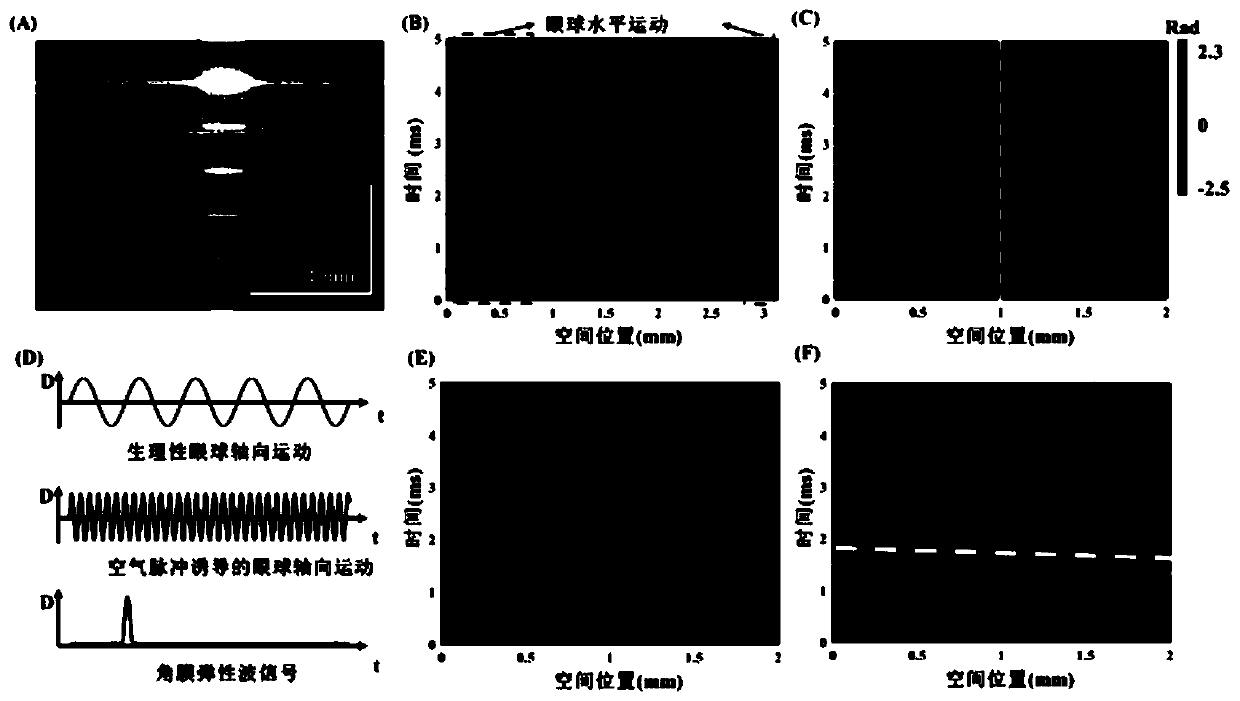Method for measuring elasticity modulus of in-vivo human cornea based on jet-propelled optical coherence elasticity imaging technology