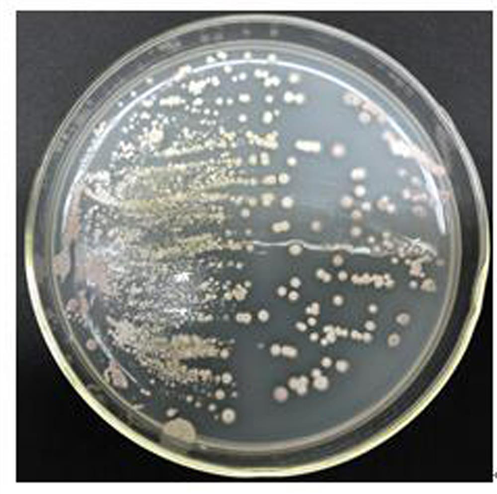 A strain of Streptomyces alginolyticus n1-32, its microecological preparation and its preparation method