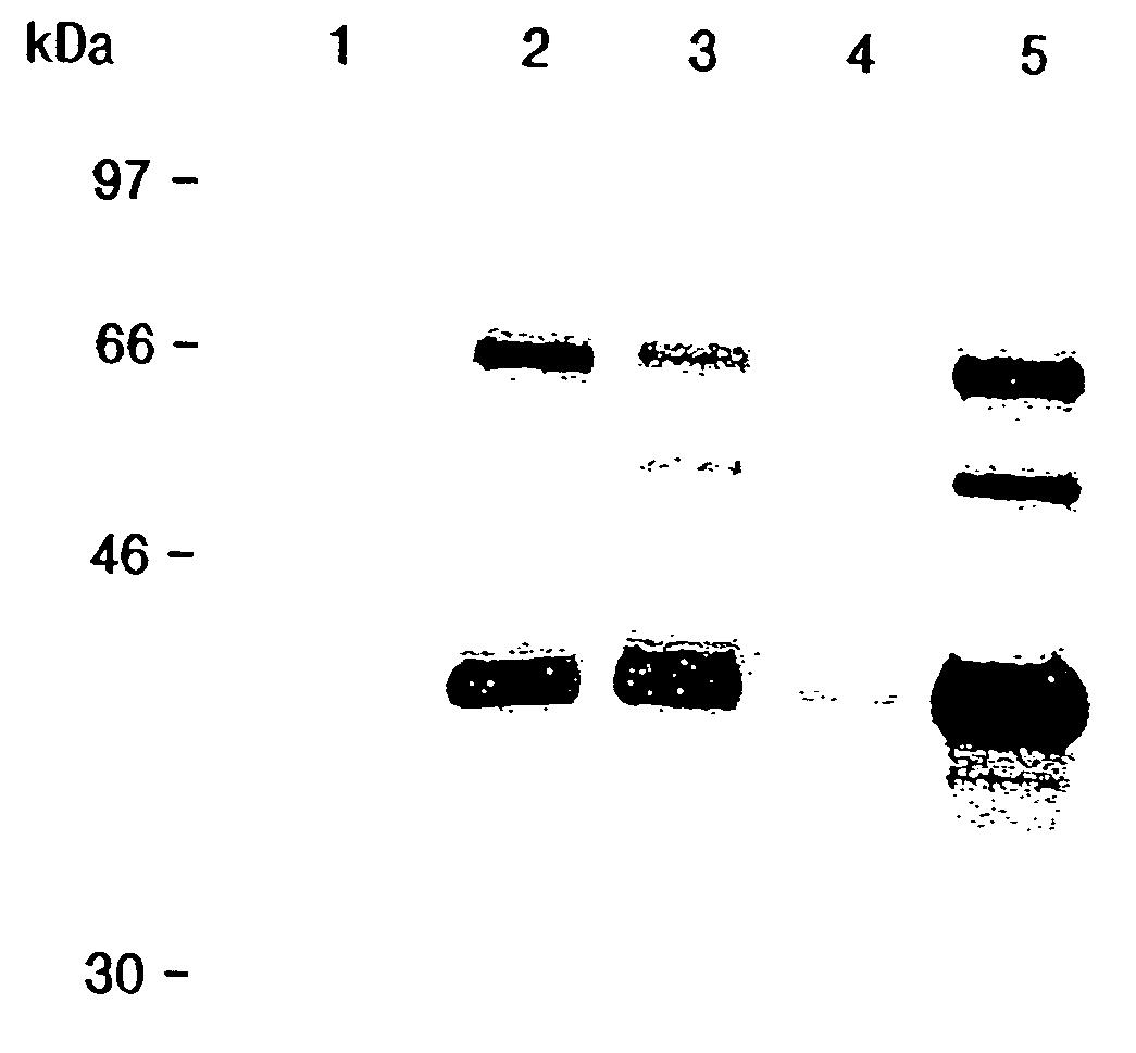 Compositions and methods for effecting the levels of high density lipoprotein (HDL) cholesterol and apolipoprotein AI very low density lipoprotein (VLDL) cholesterol and low density lipoprotein (LDL) cholesterol