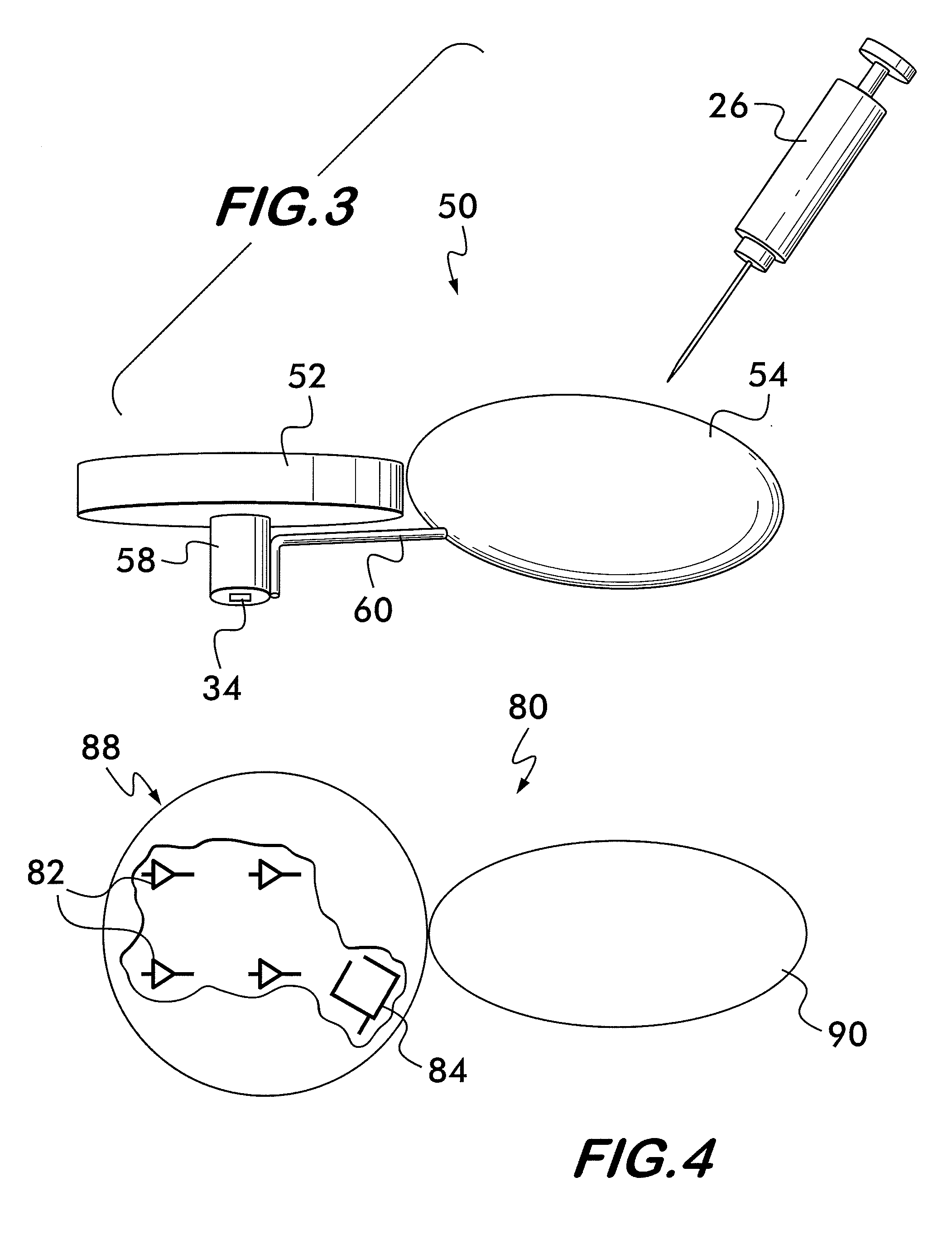 Intracranial pressure sensor