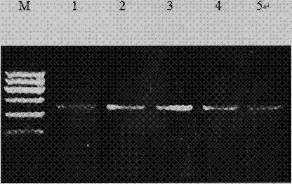 Application of NOTCH3 and JAG2 gene SNP ((Single Nucleotide Polymorphism)) loci