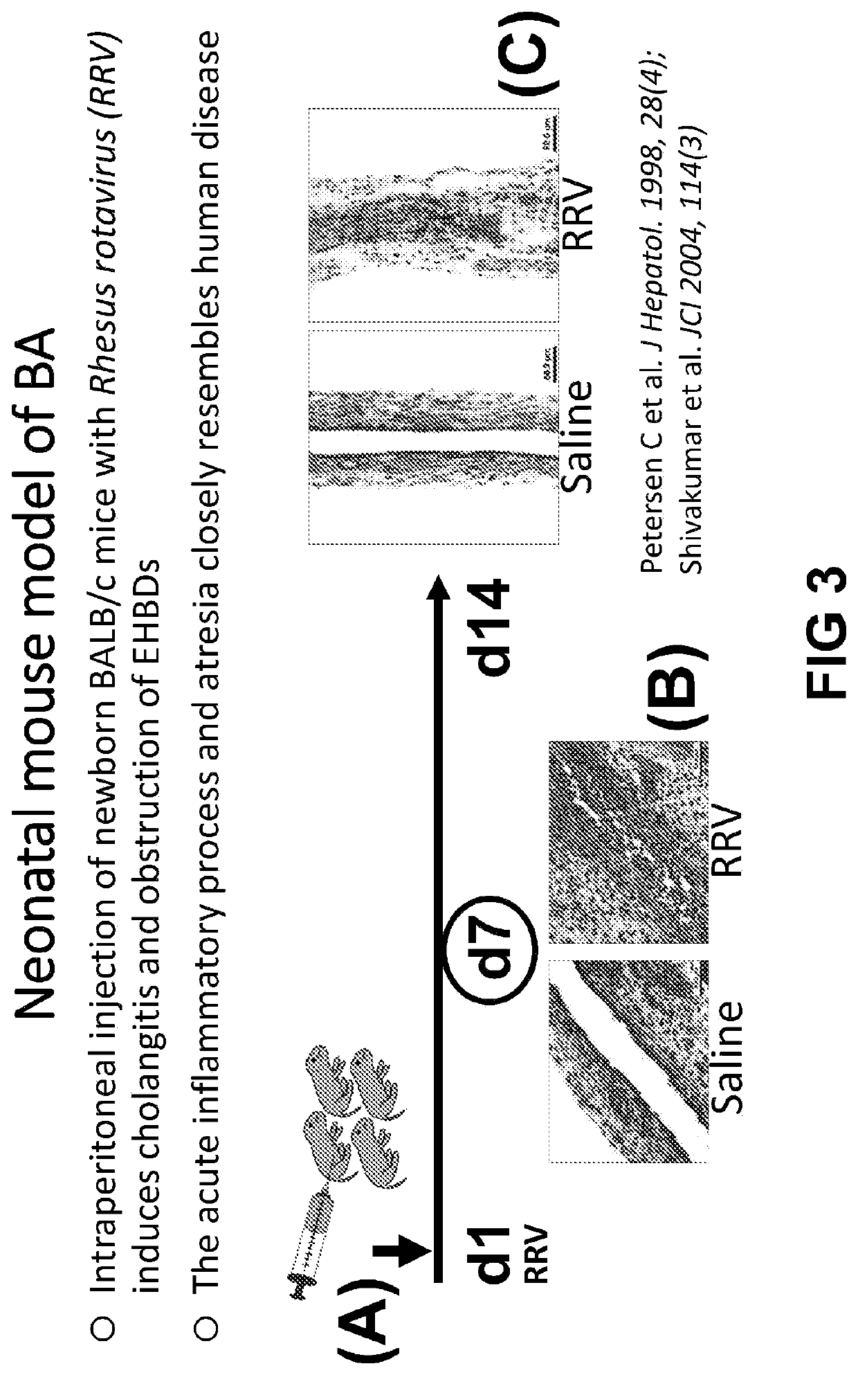 Compositions and methods for treating liver disease