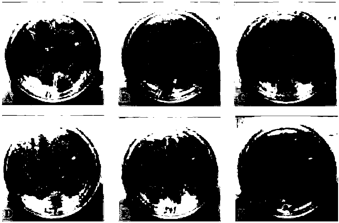 Method for screening homogenized rice chloroplast transgenic plants