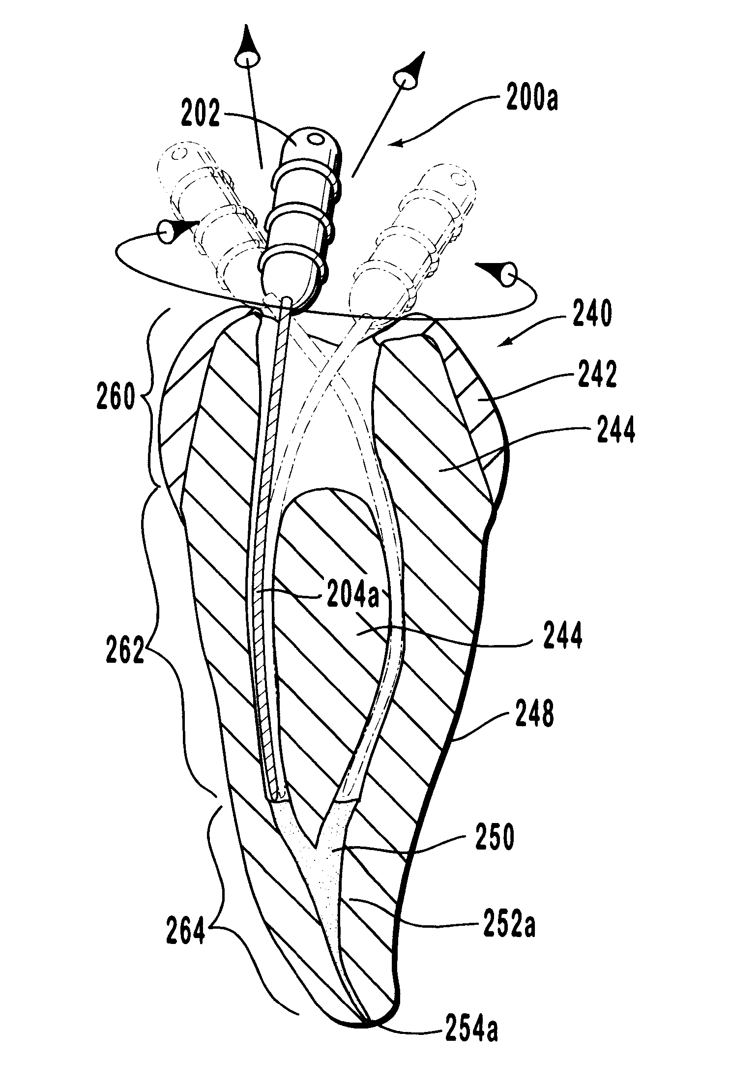 Endodontic systems and methods for the anatomical, sectional and progressive corono-apical preparation of root canals with instruments utilizing stops