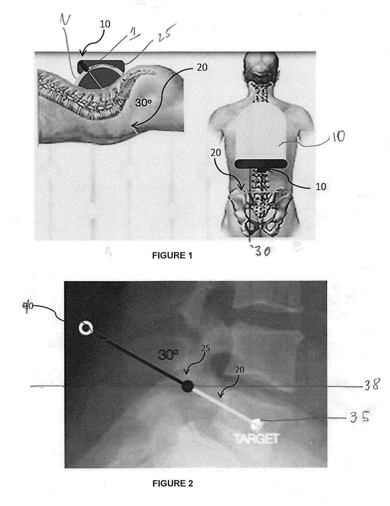 Surgical Targeting Systems and Methods