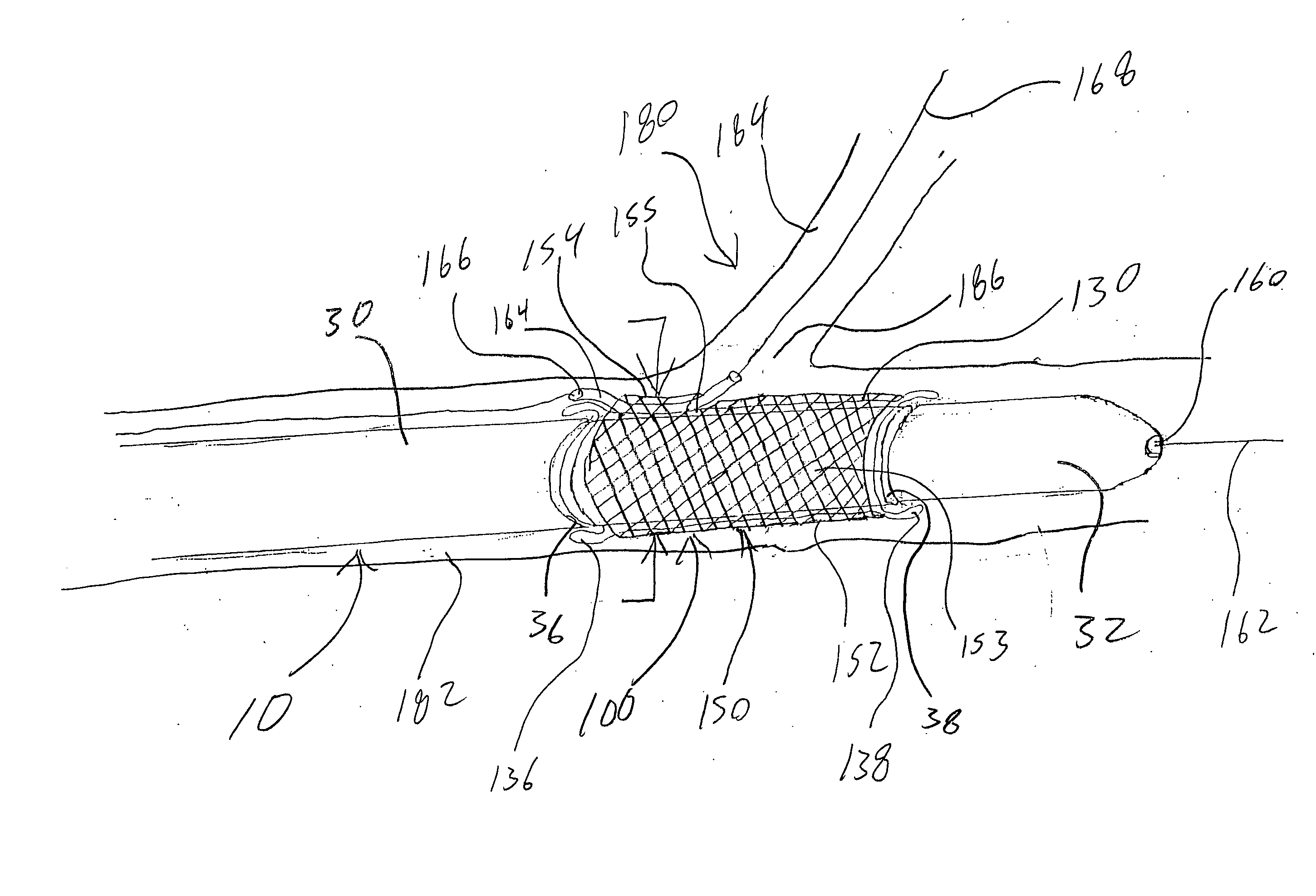 Rotating stent delivery system for side branch access and protection and method of using same