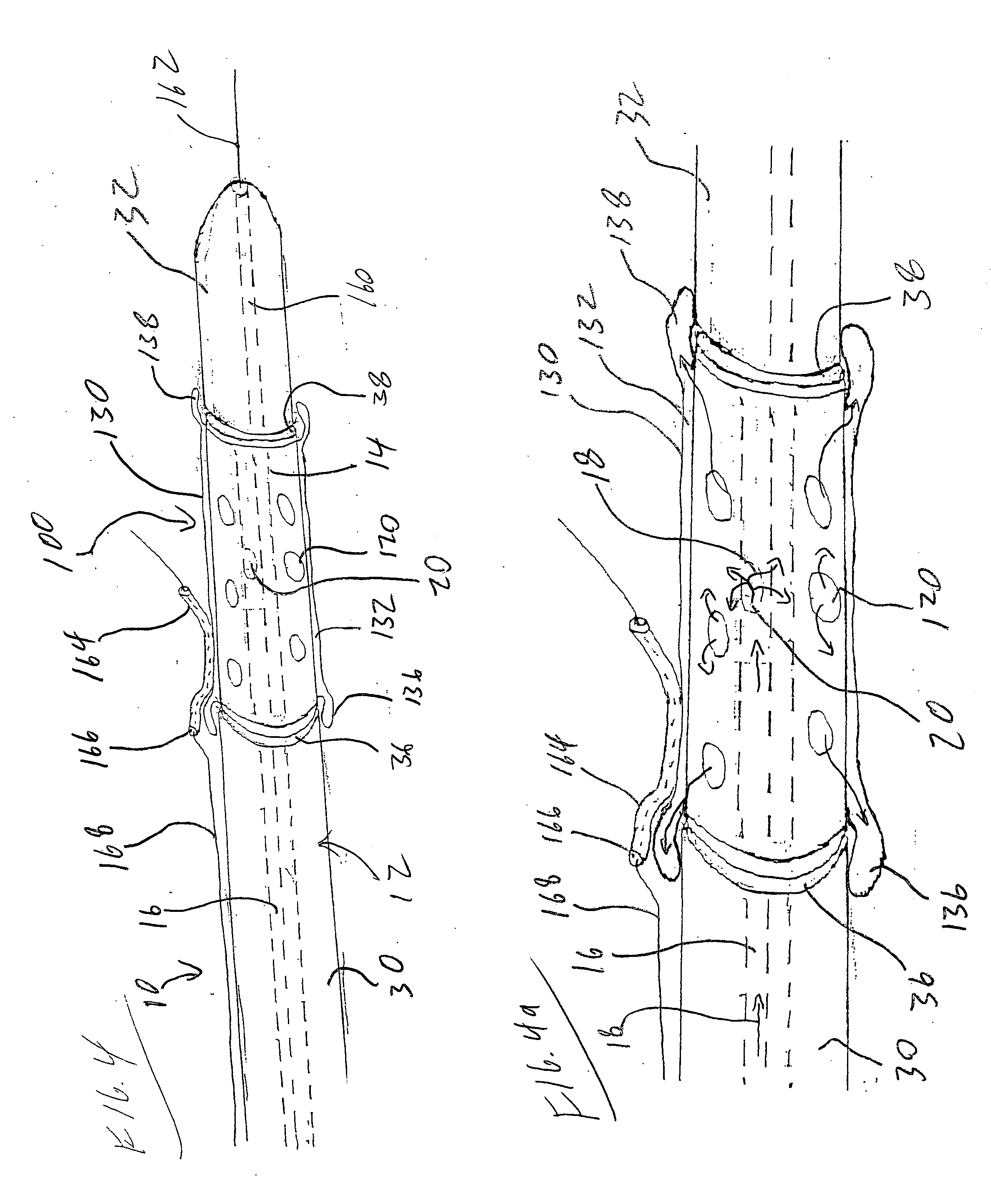 Rotating stent delivery system for side branch access and protection and method of using same