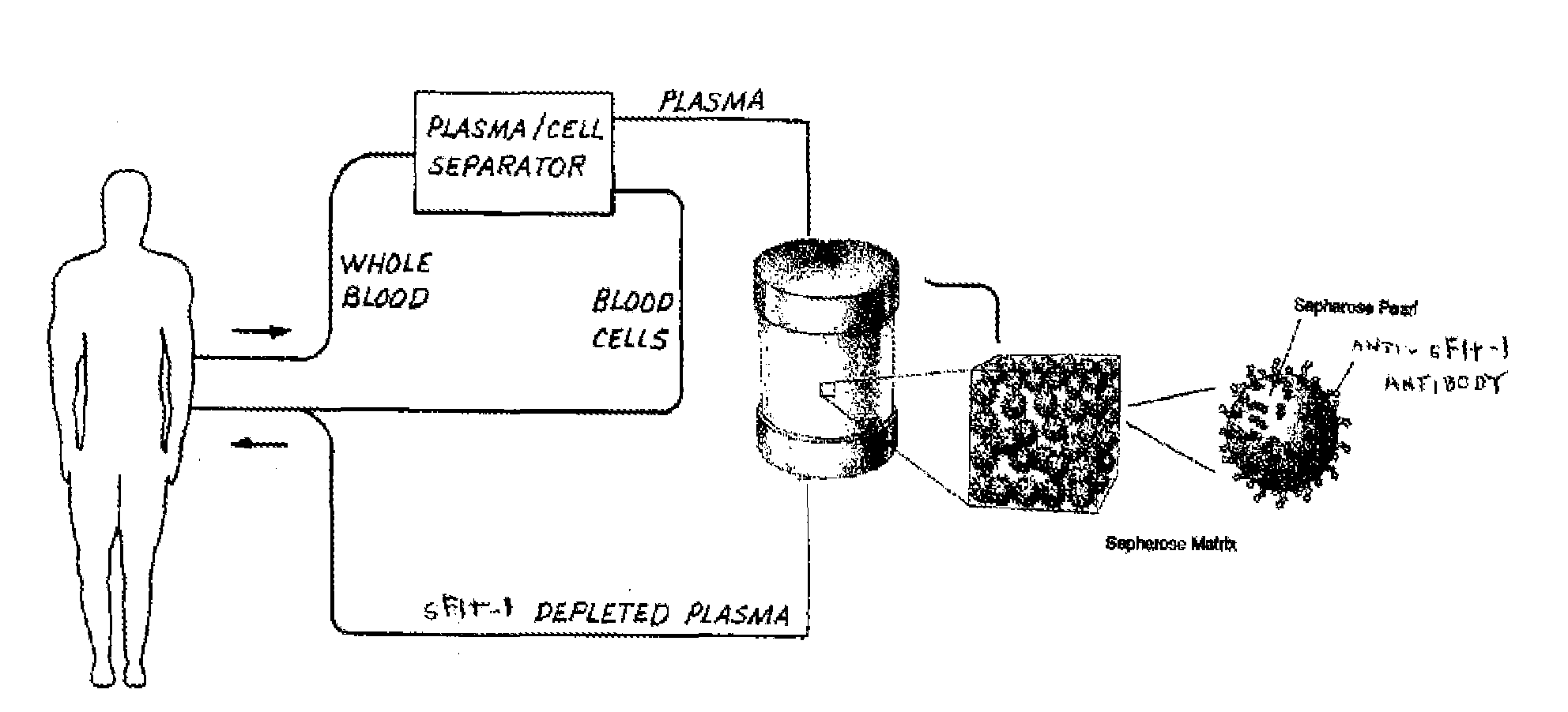 Methods and systems for treating or preventing pregnancy-related hypertensive disorders