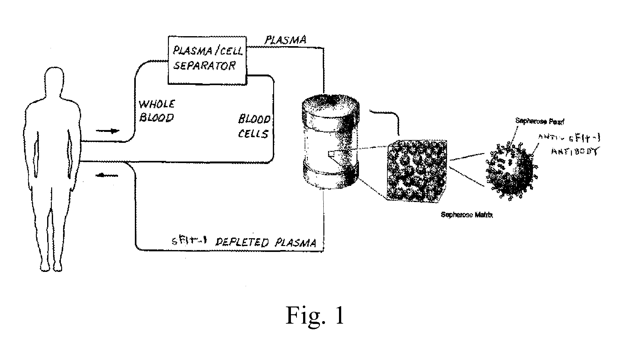 Methods and systems for treating or preventing pregnancy-related hypertensive disorders