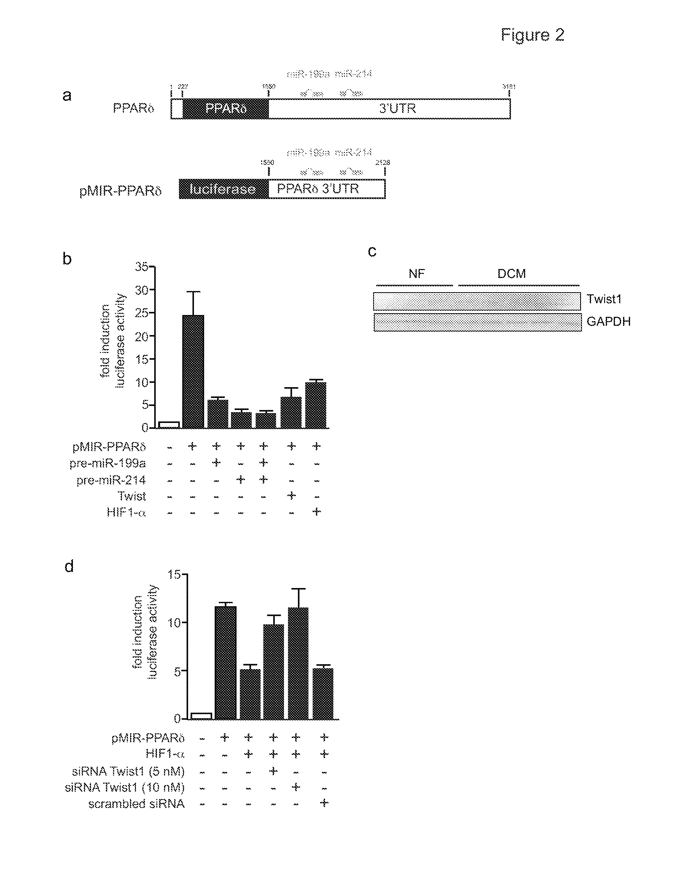 Means and methods for counteracting, delaying and/or preventing adverse energy metabolism switches in heart disease