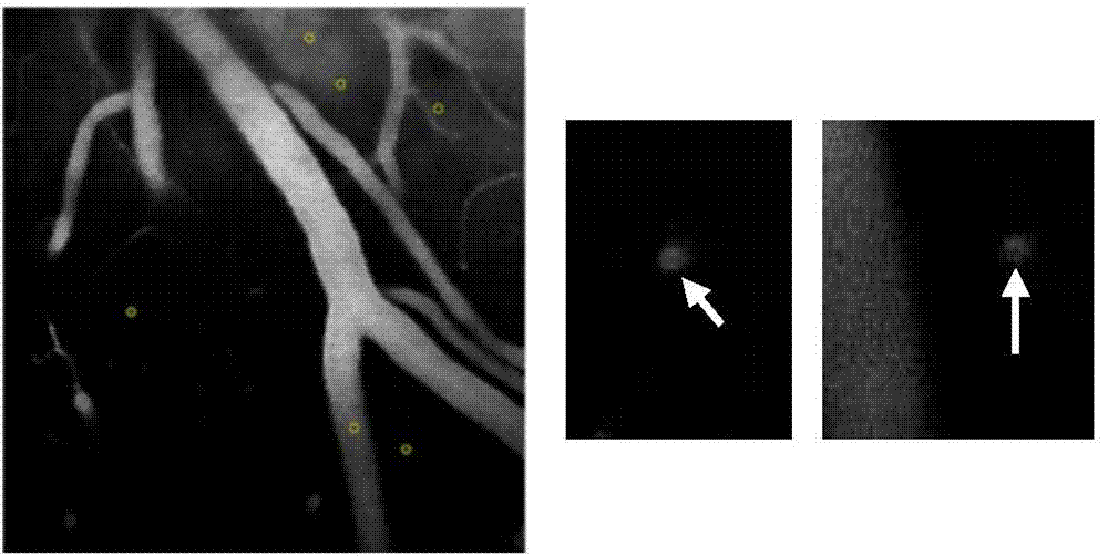 Vascular image processing method based on circular contour polarity